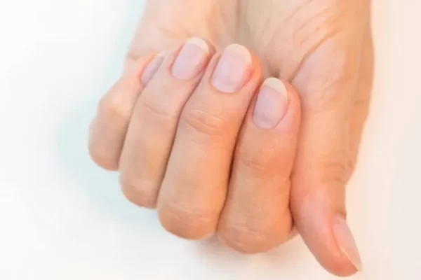 5 tips to strengthen your nails Beautiful, clear, healthy, simple